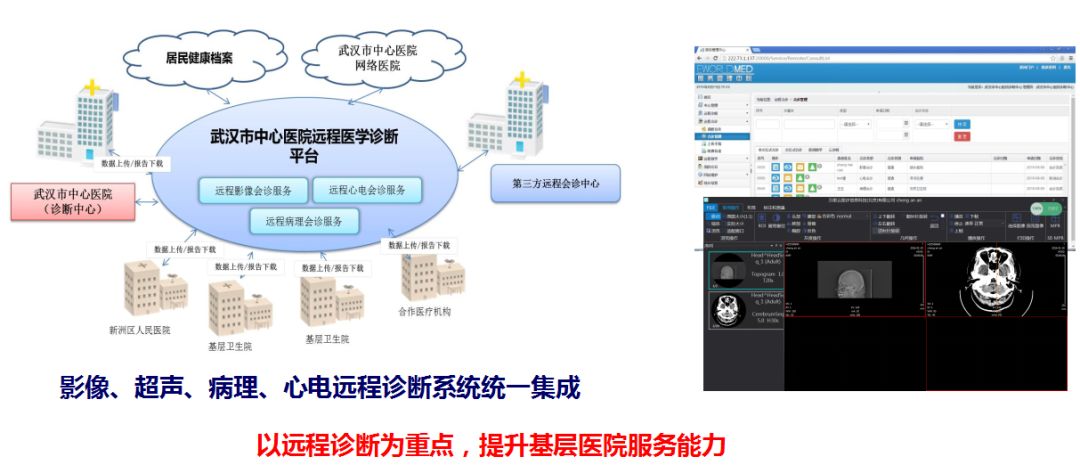 智能网络技术在智慧医疗中的远程诊断应用前景展望